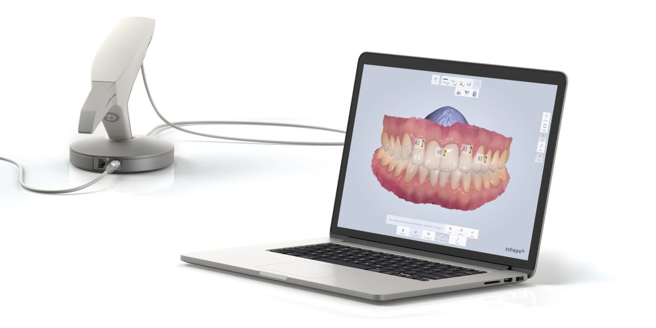 Velika novina u našoj ordinaciji – Intraoralni 3D skener (3D Shining)! VIDEO