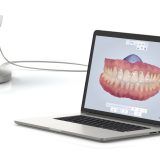 intraoralni 3d skener