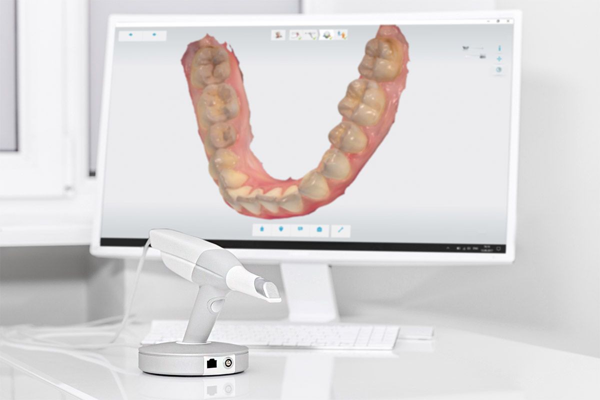 Intraoralni 3d skener