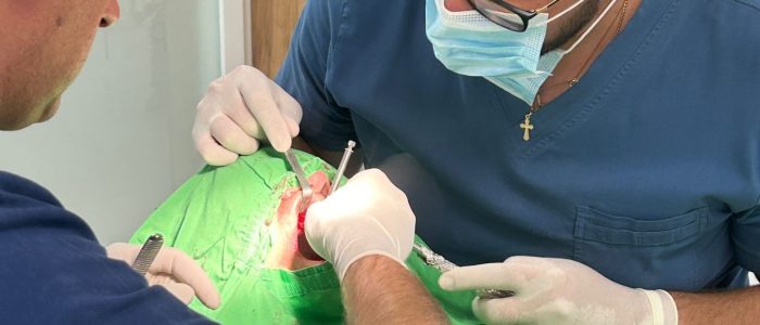 smiledent-petrovic-doboj-ugradnja-implantata Ugradnja zubnih implantata – Smile Dent Petrović Doboj