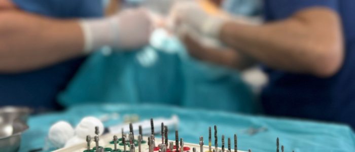 smiledent-petrovic-doboj-ugradnja-implantata Ugradnja zubnih implantata – Smile Dent Petrović Doboj